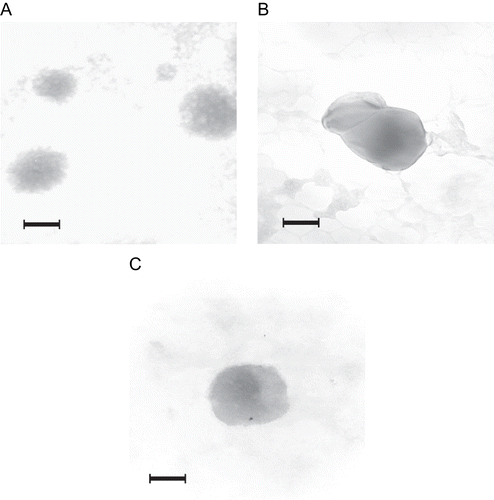 Figure 3.  TEM (the scale bar = 100 nm) of NOCC nanoparticles (A) NOCC-to-TPP weight ratio = 3, NOCC: 2 mg/ml; (B) NOCC-to-TPP weight ratio = 5, NOCC: 2 mg/ml; (C) NOCC-to-TPP weight ratio = 3, NOCC: 2 mg/ml, insulin: 0.5 mg/ml.