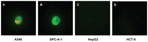 Figure 8 QDs with double-labeled Abs were used to identify the four kinds of enriched cancer cells. (A) A549 cells show green and red fluorescence. (B) SPC-A-1 cells show green fluorescence. HepG2 cells (C) and HCT-8 cells (D) do not express Lunx and SP-A proteins, no fluorescence signal was observed.Note: The magnification was 200×.Abbreviations: Abs, antibodies; MNP-pan-ck, MNPs coupled with pan-cytokeratin antibody; PBMC, peripheral blood mononuclear cell; QDs, quantum dots.