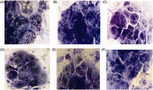 Figure 5. Light micrographs of Giemsa –stained Caco-2 cells with E. coli O157:H7 pre-treated with diferent sera (A) Negative control (only E. coli O157:H7, without pretreated by sera). (B) Non-immunized sera; (C, D, E, F) Immunized mice sera of test groups (T1, T2, T3, T4) for abbreviations see material and methods.