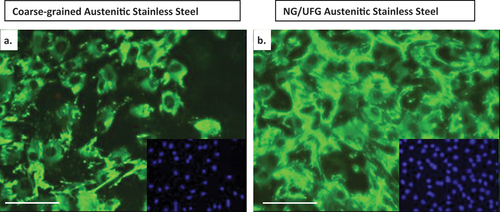 Figure 6. Fluorescence micrographs representing immunocytochemistry of fibronectin expressed by pre-osteoblasts after incubation for 2 days on (a) CG and (b) NG/UFG stainless steel surface. A higher fluorescence intensity and an expanded network of fibronectin expression along with a higher cell density is observed after labelling of cell nuclei with 4’,6-diamidino-2-phenylindole (DAPI) (inset micrographs) [Citation34–38].