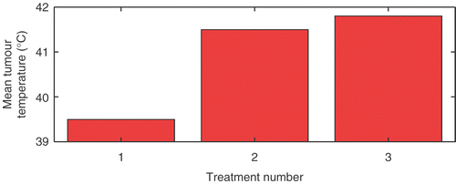 Figure 5. Mean tumour temperatures during the hyperthermia treatments. After the first treatment, the applicator set-up was changed based on treatment planning.