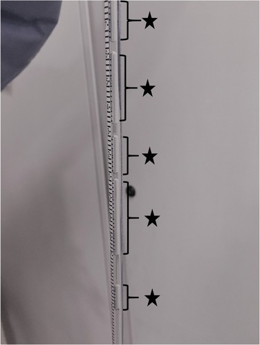 Figure 4 Example of air (stars) being entrapped in water column manometer during closing pressure making pressure reading difficult.