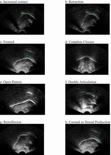 Figure 1. Example ultrasound images for various error types.