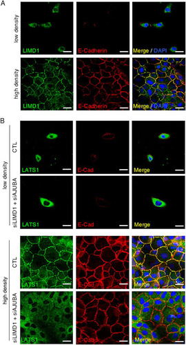 FIG 7 Cellular distribution of LIMD1 and Hippo core kinase complex components in cells. (A) MCF10A cells were cultured at low and high density, and then the cells were fixed and stained with antibodies to LIMD1 and E-cadherin. Immunofluorescence assays were performed. Nuclei were visualized with DAPI stain. (B) MCF10A cells transduced with scrambled RNAi (CTL) or AJUBA and LIMD1 RNAi were plated at LD or HD, and the cells were fixed and stained with LATS1 and E-cadherin antibodies. Immunofluorescence assays were performed. Nuclei were visualized with DAPI stain. Scale bars, 50 μm.