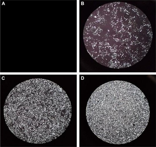 Figure 4 Polarized light microscopy photomicrographs of Tr-loaded LCG (FC) showing the effect of water content on LC formation.Notes: (A) Isotropic system formed at water content of 0.90%–8.33%. (B) Low-density LCs at 9.09% water content. (C) LC density increased at 10.57%. (D) High-density LCs at 14.73% water content (magnification ×100).Abbreviations: FC, 38.46% lecithin, 46.16% capryol, and 15.38% water; LCG, liquid crystalline nanogel; Tr, terconazole.