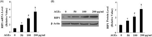 Figure 1. AGEs increased the expression of RIP1 in human chondrosarcoma SW1353 cells. SW1353 cells were treated with 50, 100 and 200 μg/mL AGEs for 24 h. (A) Real-time PCR analysis of RIP1. (B) Western blot analysis of RIP1 (*, #, $, p < .01 vs. previous column group).