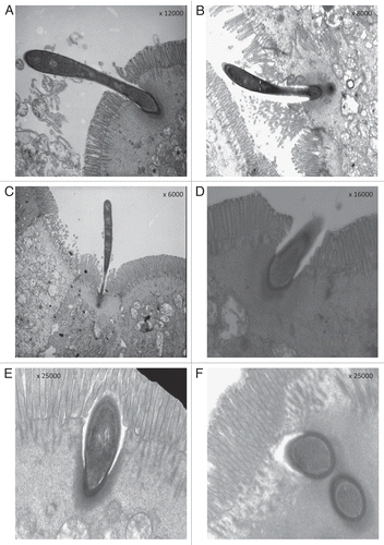 Figure 2 After the initial “bite” to the epithelial cells (A), the holdfast segments move away from the remaining part of the organisms (B and C), and only the holdfast segments penetrate more and more deeply in the epithelial cells while microvillar borders and cytoplasmic membranes seem to come back to an apparent integrity (D–F).