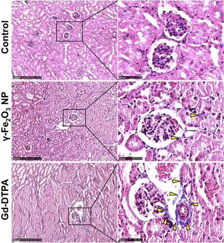 Figure 4 Histopathological images of the kidney tissue stained with Masson. The right collum was the magnified area in the rectangle box in the left collum. Scale bar in left is 250 μm, and scale bar in right is 50 μm. The arrow heads pointed the pathological changes in the tissues.