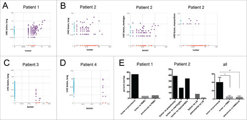 Figure 3. Analysis of TCR repertoire in tumors and irAE lesions. (A) Next generation sequencing of the complementary determining region 3 (CDR3) of the beta chain of the TCR was performed. The prevalence (frequency of reads compared to all reads in percent) is compared between inflammatory lung tissue (irAE, y-axis) and the tumor from patient 1. (B) Post-mortem frequency of T cell clones found in different tissues from patient 2. The frequency in the tumor was compared to irAE lesions of the lung (left panel), meninges (middle panel), and the myocardium (right panel). (C, D) Frequency of T cell clones in patient 3 (C) and patient 4 (D). (E) Analysis of overlap of sequences between tumor lesions and pneumonitis lesions or PBMCs/lymph node (LN). The prevalence (frequency of reads compared to all reads in percent) is compared between inflammatory lung tissue (irAE, y-axis) and the tumor from patient 1 (left panel), patient 2 (middle panel) and all analyzed patients (right panel). Analysis by one-way ANOVA, # p < 0.05.