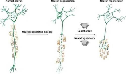 Figure 1 Application of nanotherapy to degenerated neuron for regeneration.