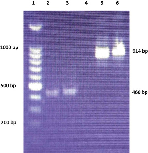 Fig. 3 (Colour online) Gel electrophoresis of PCR products amplified from P. capsici isolates MACO1 and MAL2 using Phytophthora genus-specific (COX1 & COX2) and ITS (ITS4 & 6) primer pairs. Lane 1: 100 bp marker (Promega Corporation, USA), 2: MACO1 (COX gene), 3: MAL2 (COX gene), 4: blank sample, 5: MACO1 (ITS), 6: MAL2 (ITS).