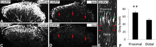 Figure 6 Axonal transport of GIRK3. (A–D) Fourteen days after unilateral dorsal rhizotomy, both CGRP- and GIRK3-LIs are largely decreased (red arrows) in ipsilateral dorsal horn compared to contralateral one. (E, F) Ten hours after sciatic nerve crush (red arrows indicate injured site), significant more GIRK3-LI is accumulated on the proximal side of the crush (green arrows) than the distal side (n = 3; **p < 0.01). Scale bars indicate 100 μm (A–D) and 50 μm (E).