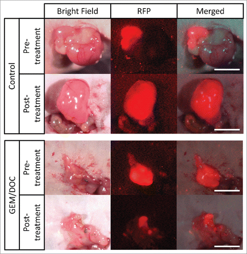 Figure 1. Imaging of drug efficacy on a leiomyosarcoma iPDOX. The PDOX model treated with GEM combined with DOC (GEM/DOC) demonstrated tumor regression. Scale bar: 5 mm.