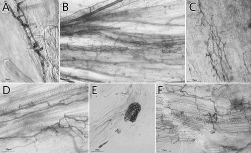 Figure 2. Morphological characteristics of the DSE colonizing the roots of the studied ‘non-mycorrhizal’ plants in Kunming CM and Gejiu Niubahuang Sn/Pb/Zn mine tailings pond (NTP), SW China. (A) dark and septate hyphae in Stellaria media in CM; (B) microsclerotia in Chenopodium album in NTP; (C) mycelial labyrinth in Silene gallica in CM; (D) dark and septate hyphae in Polygonum sp.1 in NTP; (E) brain-like microsclerotium in Polygonum capitatum in NTP; (F) dark and septate hyphae and microsclerotia in Dianthus sp. in NTP.