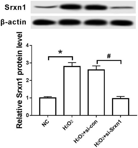 Figure 1. H2O2 inhibits Srxn1 protein expression in astrocytes. Note: compared with group NC, *P < .05; compared with group H2O2+si-con, #P < .05.