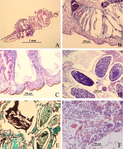 Figure 3. Invasion of Purpureocillium lilacinum strain ZJPL08 in D. citri observed under a light microscopy. (A) Control D. citri. (B − F) Fungal invasion at 6, 12, 24, 36 and 60 h post-inoculation.