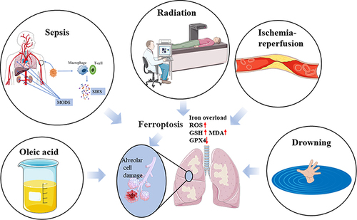 Figure 2 Ferroptosis is associated with ALI caused by ischemia-reperfusion, sepsis, radiation, drowning, and oleic acid.