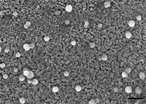 Figure 1 Scanning electron micrograph of hyperbranched polylysine nanoparticles. Scale bar = 200 nm.