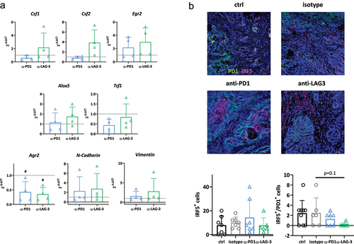 Figure 5. Gene expression analysis in residual tumors and IRF5 detection by tumor immunofluorescence.