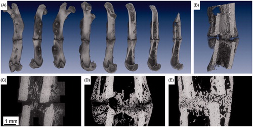 Figure 1. Two typical datasets for 2D-3D registration. Panel A shows a volume rendering of a µCT dataset visualizing a 3D model of an osteotomized rat femur with a non-critical-size osteotomy, four weeks post-osteotomy. The complete bone is rotated around the major axis and shown from different sides. Furthermore, the bone is intersected at different levels to see the inner structure. Panel B gives a higher resolved µCT scan of the osteotomy. In panel B, the bony periosteal and endosteal callus tissue is clearly detected. Panels C to E are environmental scanning electron microscopy images in backscattered electron mode (ESEM/BSE) of non-critical-size femoral osteotomies in rats at three, four, and six weeks post-osteotomy.