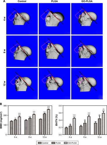 Figure 4 (A) Representative microcomputed tomography images of the proximal humerus and (B) analysis of BMD and BV/TV.Notes: Black arrows and red rectangles indicate newly formed bone between supraspinatus tendon and bone. Results are presented as the mean±SD (n=6 for each group). *P<0.05 vs control; **P<0.01 vs control; ***P<0.001 vs control; ΔΔP<0.01 vs PLGA; ΔΔΔP<0.001 vs PLGA.Abbreviations: BV/TV, bone volume/total volume; BMD, bone mineral density; GO, graphene oxide; PLGA, poly(lactic-co-glycolic acid); W, weeks.