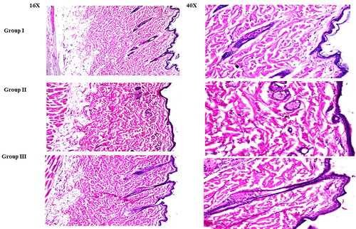 Figure 9. Light microscope photomicrographs showing histopathological sections (hematoxylin and eosin-stained) of rat skin in normal control (group I), rat skin treated with LVC solution (group II), and rat skin treated with optimum CCPCs (group III) with a magnification power of 16X to illustrate all skin layers (Left side) and magnification power of 40X to identify the epidermis and dermis (Right side).Abbreviation: LVC: levocetirizine hydrochloride, and CCPCs; cationic ceramide/phospholipid composite.