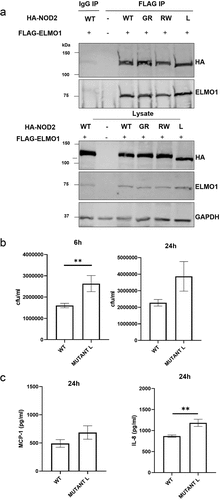 Figure 2. The involvement of NOD2 mutant in bacterial clearance and in inflammation. a. HEK293 cells were co-transfected with Flag-ELMO1 and with HA-NOD2 [WT and mutant (GR - G908 R, RW – R702W, L - L1007fs)]. After transfections, cells were lysed, normalized for protein content and precipitated using anti-FLAG antibody. Immunoprecipitants and cell lysates were visualized by immunoblotting with corresponding antibodies. b. HEK293 cells were transfected with vectors over-expressing ELMO1 and BAI1, with either NOD2 WT or NOD2L1007fs (Mutant L). Cells were infected with AIEC-LF82 for 6h and gentamicin was used to kill extracellular bacteria. The bacterial count at 6 h and 24 h were plotted from three different experiments. c. the supernatant from B at 24 h was used to measure cytokine by ELISA.Results shown are mean ± SEM Mann Whitney test showed p value of < 0.01 represented as**.