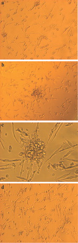 Figure 1 Endothelial progenitor cells and endothelial colony forming units under light microscopy. Note that the size of colony forming units(CFUs) varies widely. a: small CFUs consisting of a few cells (40×); b and c: bigger CFUs (40×, 100×); d: predominantly single located endothelial cells without accumulation in CFUs (40×).