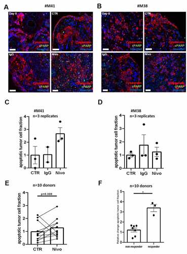 Figure 3. PD-1 inhibition in PDTC of GC and EGJC. (a, b) Representative immunofluorescence images of apoptotic tumor cells at day 0 and 4 days (CTR) ex vivo. Nivolumab and its respective IgG were applied for 72 h. (C, D, E) Quantification of the apoptotic tumor cell fraction after treatment normalized to the respective control condition in two single cases (#M38 and #M41) and in 10 different donor specimens respectively. (f) A change of the apoptotic tumor cell fraction greater than ∆2.5 was set as cut off for discrimination of Nivolumab responder and non-responder (*p ≤ 0,05; Mann-Whitney-U test, n = 10 patients). Hoechst, blue; Cytokeratin, red; cPARP, green, control (CTR), Nivolumab (Nivo, 3 µg/ml) and IgG (3 µg/ml); bars = 20 µm; error bars: SEM