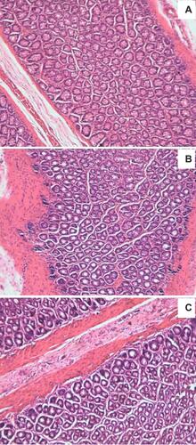 Figure 12 The morphology of rectal tissues after rectal administration of IBU-SLN-ISG and IBU-ISG: (A) control group, (B) 6 h after rectal administration of IBU-SLN-ISG, and (C) 6 h after rectal administration of IBU-ISG.