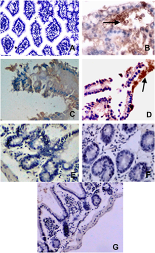 Figure 1 Immunohistochemical analysis of Cryptosporidium antigen in intestinal mice tissues of different groups: the control group and T1, T2, T3, T4, T5, and T6 were respectively represented in (A–G).