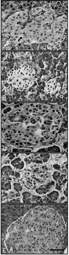 Figure 2.  The histological effects of exopolysaccharide in pancreas of streptozotocin treated rats. Non-diabetic animals given saline as negative control (A), diabetic animals animals given saline as diabetic control (B), diabetic animals animals given Cerrena unicolor exopolysaccharide at 100 mg/kg dose (C), diabetic animals animals given Coprinus comatus exopolysaccharide at 100 mg/kg dose (D), diabetic animals animals given Lenzites betulina exopolysaccharide at 100 mg/kg dose (E). Scale bar: 125 μm