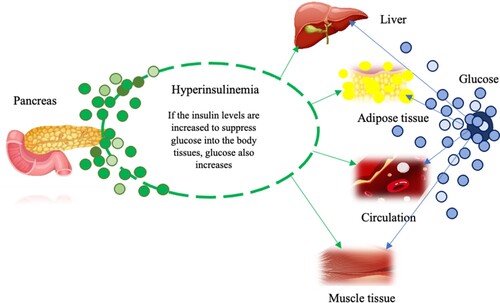 Figure 1. Hyperinsulinemia process.