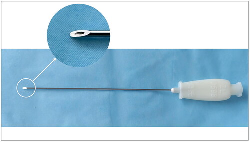 Figure 7. Picture of injection acupotomy.