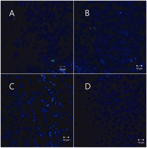 Figure 4. Confocal images of the modiolus (A, C) and lateral wall (B, D) in the nanoparticle and Nile red groups. Nile red and FITC fluorescence signals were readily identified in the nanoparticle group (A, B), but little Nile red fluorescence was observed in the Nile red group (C, D).