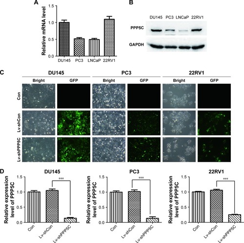 Figure 2 Lentivirus-mediated interference downregulates PPP5C expression in PCa cells.