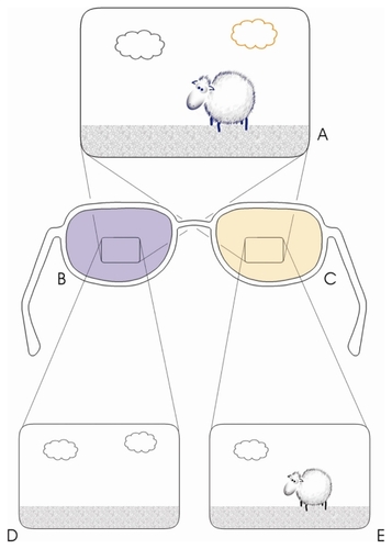 Figure 1 A diagram of the anaglyphic system for amblyopia treatment. The display (A) consists of elements that, based on color, may be visible by one or both eyes. The filter for the unaffected eye (B) filters out main moving elements (D), while the filter of the amblyopic eye (C) allows for the eye to see the main elements and may or may not filter out less significant features (E).