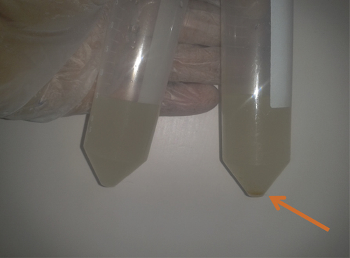 Figure 3. Nano-encapsulation renders quercetin completely dispersible in aqueous media. Free quercetin is poorly soluble in aqueous media. In contrast the equivalent quantity of quercetin encapsulated in liposomes is fully dispersible in aqueous media.