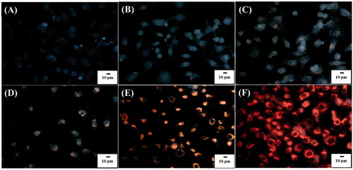 Figure 4. Dark field optical images of L929 cells (1 ml, ∼106 cells/well) obtained after the treatment with POA-Au NPs at the concentations of (A) 0, (B) 62.5, (C) 125, (D) 250, (E) 500 and (F) 1000 µgmL−1 for 6 h, respectively. Exposure time was set to 40 ms. The scale bar is 10 µm.