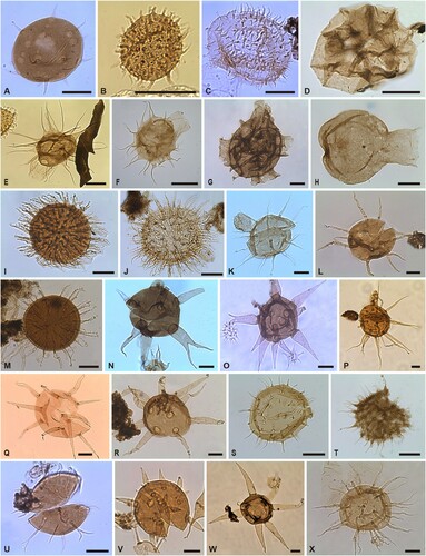 Figure 4. Organic-walled phytoplankton of the Borenshult-1 drillcore. Taxon, sample number, and England Finder Reference (EFR). Scale bars 20 μm. A. Actipilion sp. A, (40.2 m) EFR: E30/0; B. Ammonidium cf. A. minimum, (39.35 m) EFR: L15/0a; C. Ammonidium sp. A, (40.35 m) EFR: F31/0; D. Ampullula suetica, (71.1 m) EFR: L16/2b; E. Aremoricanium rigaudiae, (39.5 m) EFR: E17/4a; F. Aremoricanium rigaudiae, (71.1 m) EFR: N14/4a; G. Aremoricanium cf. A. carolineae, (43.1 m) EFR: F36/1b; H. Aremoricanium simplex, (71.1 m) EFR: R30/0a; I. Baltisphaeridium accinctum, (43.1 m) EFR: D16/2a; J. Baltisphaeridium cf. B accinctum, (48.2 m) EFR: S37/0b; K. Baltisphaeridium adiastaltum, (36.7 m) EFR: G27/4a; L. Baltisphaeridium aliquigranulum, (41.1 m) EFR: G16/1a; M. Baltisphaeridium annelieae, (59.1 m) EFR: K18/4b; N. Baltisphaeridium bramkaense, (39.35 m) EFR: Q20/0b; O. Baltisphaeridium bramkaense, (40.35 m) EFR: O38/0; P. Baltisphaeridium bystrentos, (59.1 m) EFR: V37/0b; Q. Baltisphaeridium calicispinae, (37.0 m) EFR: H39/2a; R. Baltisphaeridium constrictum, (71.1 m) EFR: K32/0a; S. Baltisphaeridium curtatum, (59.1 M) EFR: N30/1b; T. Baltisphaeridium cf. B. dasos, (59.1 m) EFR: M38/2b; U. Baltisphaeridium delicatum, (40.35 m) EFR: E16/0; V. Baltisphaeridium cf. B. digitiforme, (41.1 m) EFR: G16/1b; W. Baltisphaeridium dispar, (67.6 m) EFR: O17/0a; X. Baltisphaeridium disparicanale, (67.6 m) EFR: U29/0a.