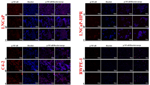 Figure 5. Immunofluorescence analysis shows the effect of the increasing Cab concentrations on the p-NF-κB expression and subcellular localization in the Cab-treated cell lines. On the horizontal axis of the microphotograph group for each cell line, (a) control, (b) 5 nM, and (c) 10 nM cab. For each group, six independent images were obtained. In the groups for each cell line, the last two columns are the merged images for the indicated protein and nuclear staining with Hoechst dye. The scale bar represents 100 µm at 20X magnification. However, the microphotographs in the last column were obtained as larger images using a 50 µm scale bar at 20X magnification.