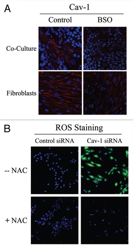 Figure 2 Glutathione depletion is sufficient to induce Cav-1 downregulation and Cav-1 knock-down induces ROS production: A feed-forward mechanism for oxidative stress. (A) treatment with the glutathione synthase inhibitor BSO downregulates Cav-1 in fibroblasts. Fibroblast-MCF7 co-cultures and hTERT-fibroblast homotypic cultures were incubated with vehicle alone (control) or with the glutathione synthaset inhibitor BSO (1 µM), which generates ROS via glutathione depletion. Cells were fixed and immuno-stained with anti-Cav-1 (red) antibodies. DAPI was used to stain nuclei (blue). Note that BSO treatment decreases Cav-1 levels in co-cultured fibroblasts and homotypic cultures. Importantly, images were acquired using identical exposure settings. original magnification, 40x. (B) Cav-1 knock-down induces ROS production. CM-H2DCFDA staining (green) was performed on hTERT-fibroblasts treated with Cav-1 siRNA (right) or control siRNA (left). Cells were counterstained with Hoechst nuclear stain (blue). Samples were then immediately imaged using a 488 nm excitation wavelength. As a critical control, cells were pre-incubated with the ROS scavenger NAC in parallel. Note that Cav-1 knock-down greatly promotes ROS generation. As expected, NAC blocks ROS accumulation. Importantly, images were acquired using identical exposure settings. Original magnification, 20x.