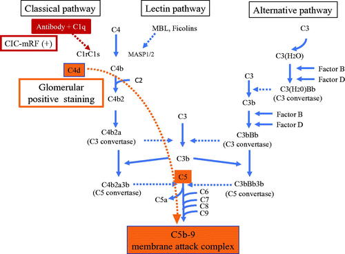 Figure 6. Outline illustration of complement activation system with our hypothesis of their role in MPO-AAGN. Serum and histological analysis suggest that CICs activate the classical complement pathway, leading to activation of the final common pathway and formation of C5b-9 in patients with MPO-AAGN.
