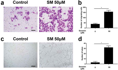 Figure 3. Sesamin enhanced migration and tube formation of HUVECs.