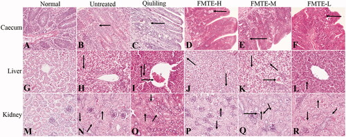 Figure 3. The pathological lesions of tissues in the different groups. (←) in (B)–(F) indicated oocysts in the intestinal mucosa; (→) in (I), (K) and (Q) indicated congestion; (↓) in (H)–(K), (N)–(P) and (R) indicated vacuolar degeneration ; (↑) in (I), (L) and (N)–(R) indicated granular degeneration in renal tubular epithelial cells; (↖) in (J) and (K) indicated inflammatory cell infiltrated; (↗) in (N) and (O) indicated the tubular lumen of renal tubules was narrowed; (↙) in (Q) and (R) indicated eosinophils infiltration; (↘) in (Q) indicated neutrophil infiltration.