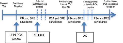 Figure 1 Diagram representing a common trajectory in men who are candidates for prostate biopsy based on PSA or prior history of prostate cancer.Abbreviations: PSA, prostate-specific antigen, PCa, prostate cancer, REDUCE, Reduction by Dutasteride of Prostate Cancer Events, DRE, digital rectal exam, AS, active surveillance.