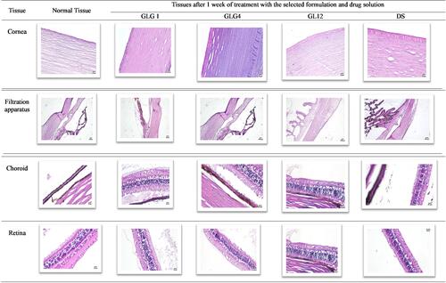 Figure 7 Histological examination of the rabbits’ eye-tissues after one week of treatment with the selected formulation and the drug solution; the control eye (untreated tissue), treated group with GLG1, treated group with GLG4, treated group with GL12 and treated group with drug solution (magnification is 10×).