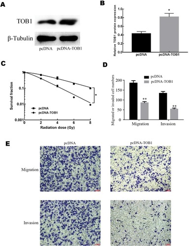 Figure 3 The effects of TOB1 on radiosensitization, migration and invasion of colorectal cancer cell. (A) Western blot showed that the overexpression plasmid of pcDNA-TOB1 obviously increased the expression of TOB1 protein. (B) qRT-PCR results showed that the overexpression plasmid of pcDNA-TOB1 obviously increased the expression of TOB1 mRNA. (C) Overexpression of TOB1 significantly enhanced the radiosensitization of colorectal cancer SW480 cells. (D) Overexpression of TOB1 significantly decreased the migrated cell numbers and the invaded cell numbers. (E) Images of migrated and invaded cells of SW480 cell. Data are reported as means ± standard deviation of three independent experiments. *p<0.05; **p<0.01.