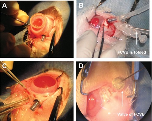 Figure 2 Rabbit foldable capsular vitreous body (FCVB) with levofloxacin was implanted in vivo. (A) Pars plana vitrectomy was performed on the right eye, (B) the capsule of FCVB was folded, (C) FCVB was implanted into the vitreous cavity, and (D) levofloxacin solution was injected into the capsule through the valve.