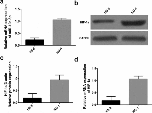 Figure 1. miR-19a-3p and HIF-1α expression. (a) The levels of HIF-1α were determined by WB (b) and qRT-PCR (c) MiR-19a-3p mRNA level was detected through qRT-PCR. (d) Results pointed out miR-19a-3p and HIF-1α levels in KG-1 cells were higher than HS-5 cell lines